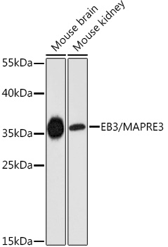 MAPRE3 Rabbit Polyclonal Antibody