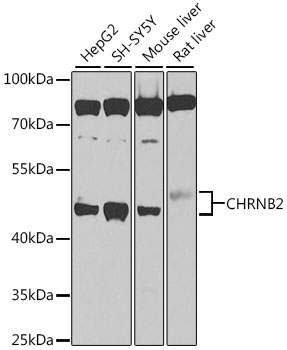CHRNB2 Rabbit Polyclonal Antibody