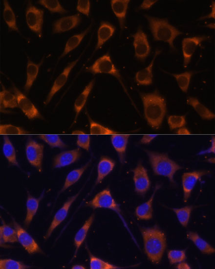 LAMB1 Rabbit Polyclonal Antibody