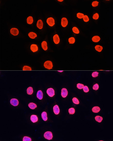 Histone H3K9me1 Polyclonal Antibody