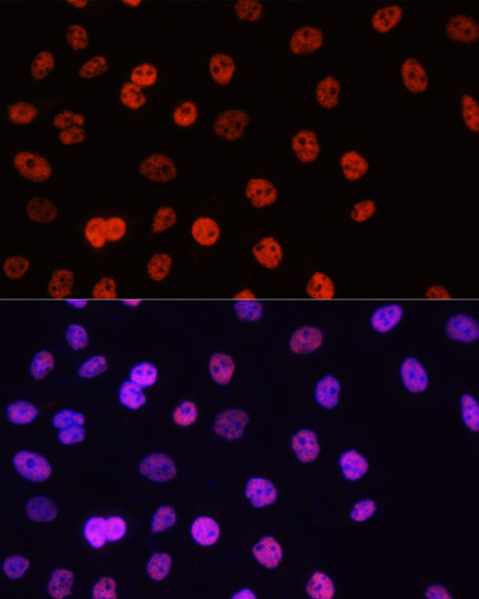 Histone H3R17me2a Polyclonal Antibody