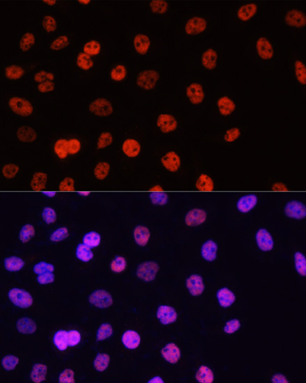 Histone H3R17me2a Polyclonal Antibody