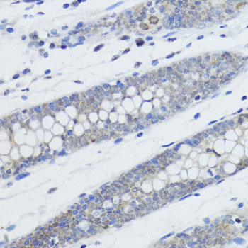 Histone H4K20me1 Polyclonal Antibody