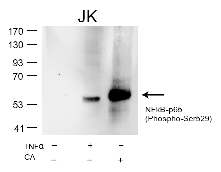 NFkB-p65(Phospho-Ser529) Antibody