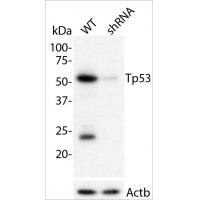 p53 Mouse Monoclonal Antibody