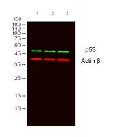p53 Mouse Monoclonal Antibody