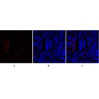 TIMP-1 Polyclonal Antibody