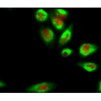 Bcl-2 Monoclonal Antibody