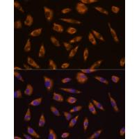 GLP1R Rabbit Polyclonal Antibody