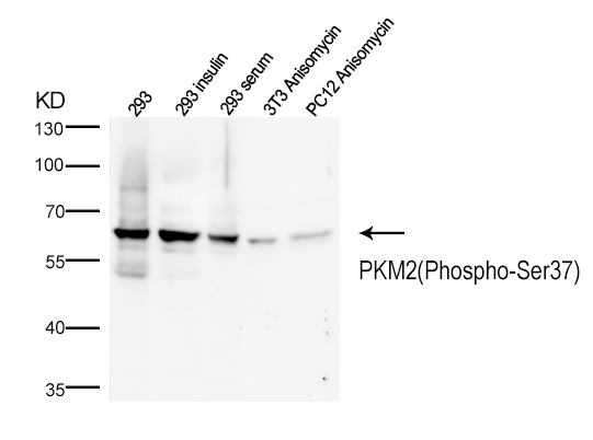 PKM2(Phospho-Ser37)  Antibody - SAB | Signalway Antibody