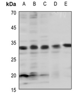 BCL-2 (Phospho-Thr69) Antibody
