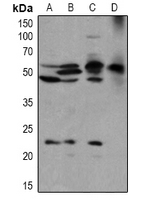BLK (Phospho-Tyr389) Antibody