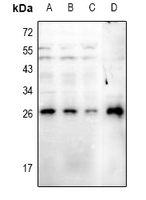 GAIP (Phospho-Ser151) Antibody