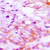 Lrp2 / Megalin Antibody