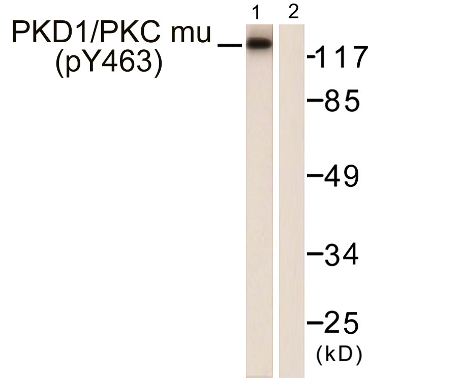 PKD1/PKC μ (Phospho-Tyr463) Antibody