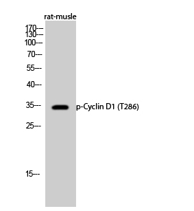 Cyclin D1 (Phospho-Thr286) Antibody