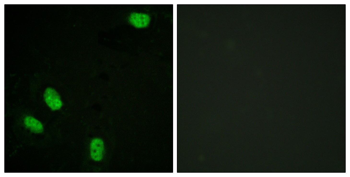 Progesterone Receptor (Phospho-Ser294) Antibody