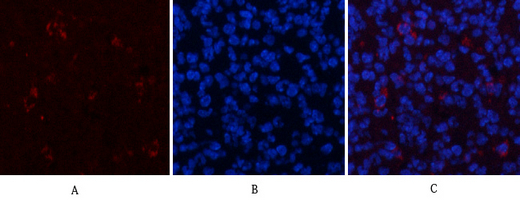 ERK1/2 (Phospho-Thr202/Tyr204) Antibody