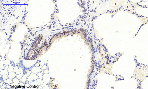 ERK1/2 (Phospho-Thr202/Tyr204) Antibody