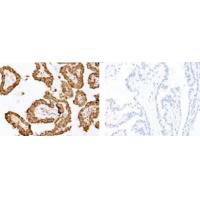 SLC5A5 Antibody