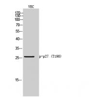 p27 Kip1 (Phospho-Thr198) Antibody