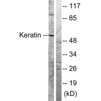 KRT8 Antibody