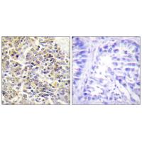 ASC Polyclonal Antibody