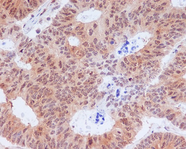 eIF2 alpha (Phospho-Ser51) Rabbit mAb