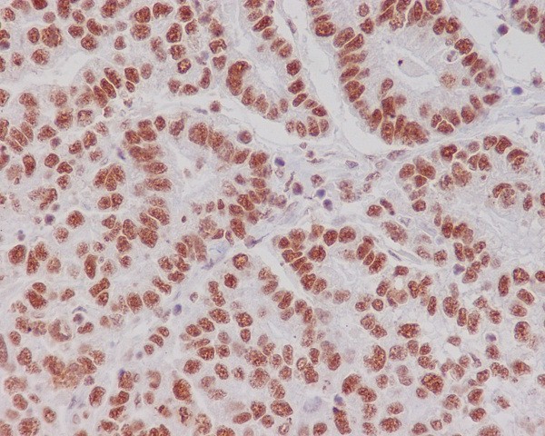 Creb (Phospho-Ser133) Rabbit mAb