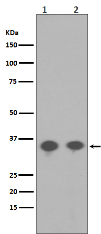 PP2A alpha (Phospho-Tyr307) Rabbit mAb