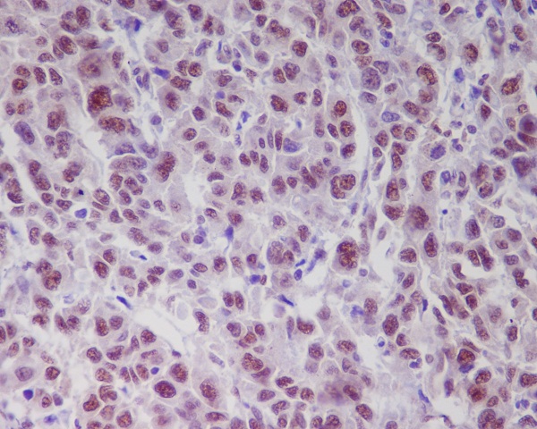 ATM (Phospho-Ser1981) Rabbit mAb