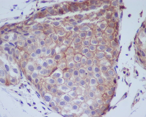 EGFR (Phospho-Tyr1068) Rabbit mAb  