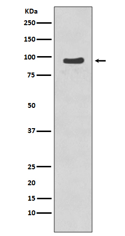 p95/NBS1 (Phospho-Ser343) Rabbit mAb 