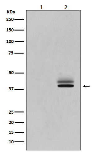 Erk1/2(Phospho-T202/Y204+T185/Y187) Rabbit mAb