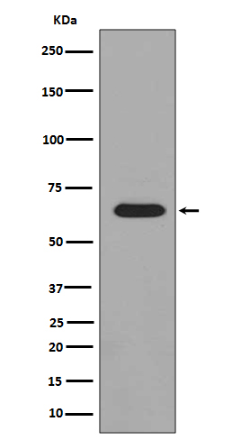 PAK1/2/3 (Phospho-Ser144/Ser141/Ser139) Rabbit mAb