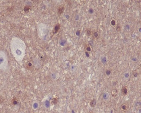 PAK1/2/3 (Phospho-Ser144/Ser141/Ser139) Rabbit mAb