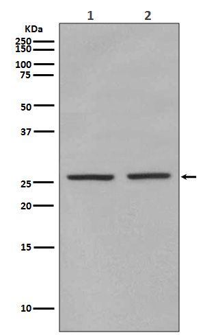 eIF4E (Phospho-Ser209)  Rabbit mAb