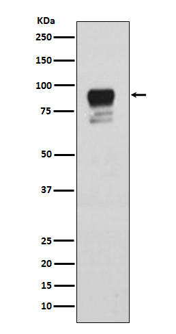 Glycogen synthase 1 (Phospho-Ser641) Rabbit mAb