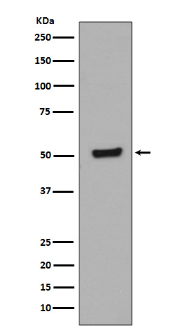 p53 (Phospho-Thr55) Rabbit mAb