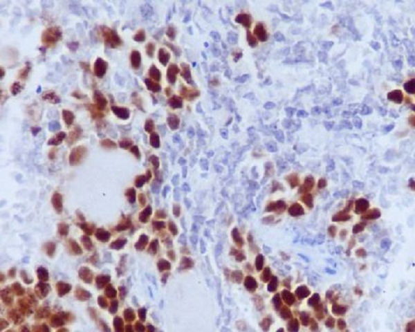 Retinoblastoma (Phospho-Ser807) Rabbit mAb 