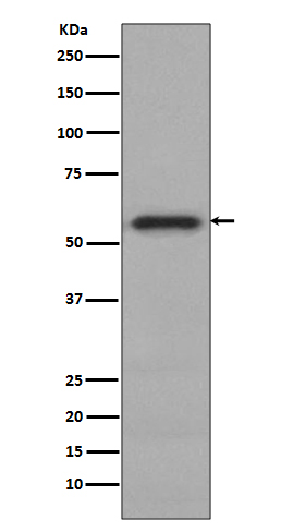 c-Myc (Phospho-Ser62) Rabbit mAb 