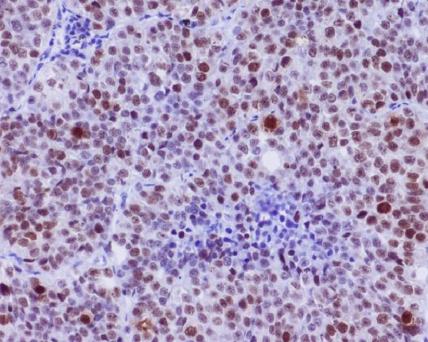 c-Myc (Phospho-Ser62) Rabbit mAb 