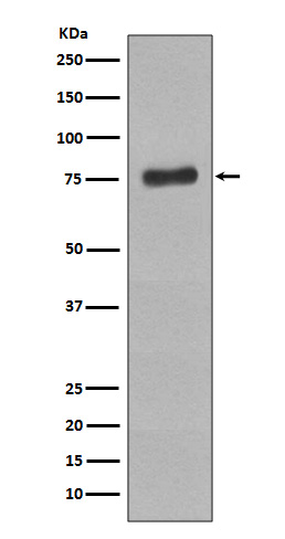 BTK (Phospho-Tyr223) Rabbit mAb 