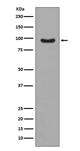 FoxO3a (Phospho-Ser253) Rabbit mAb 