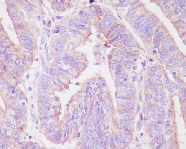 FoxO3a (Phospho-Ser253) Rabbit mAb 