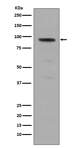 Stat5 (Phospho-Tyr694) Rabbit mAb