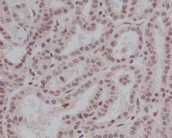 Stat5 (Phospho-Tyr694) Rabbit mAb