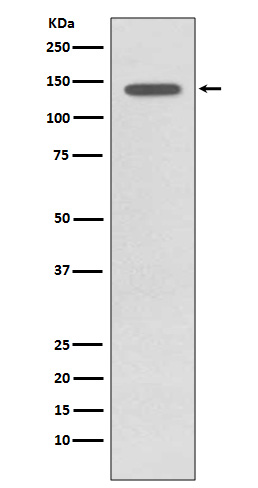 TrkB (Phospho-Tyr817) Rabbit mAb