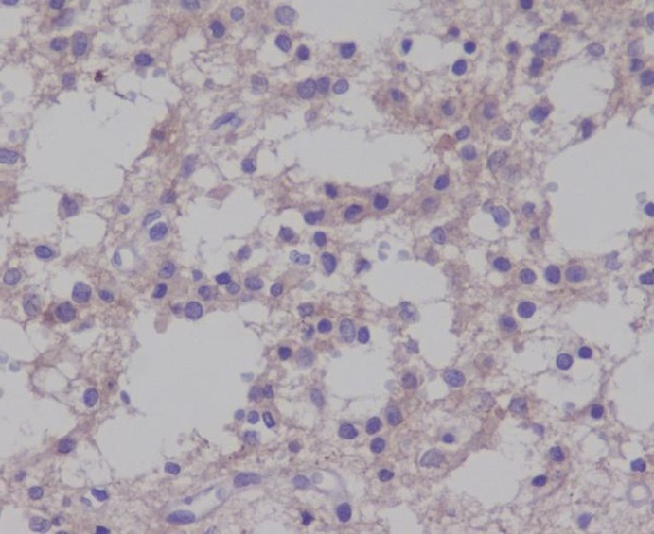 TrkB (Phospho-Tyr817) Rabbit mAb