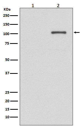 IRE1 (Phospho-Ser724) Rabbit mAb